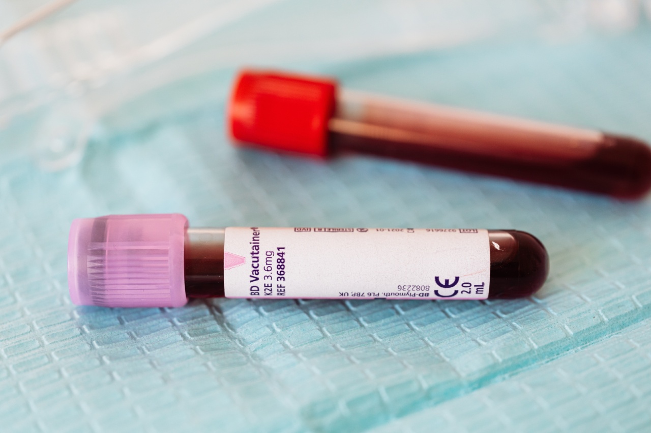 Depression diagnosis via blood test