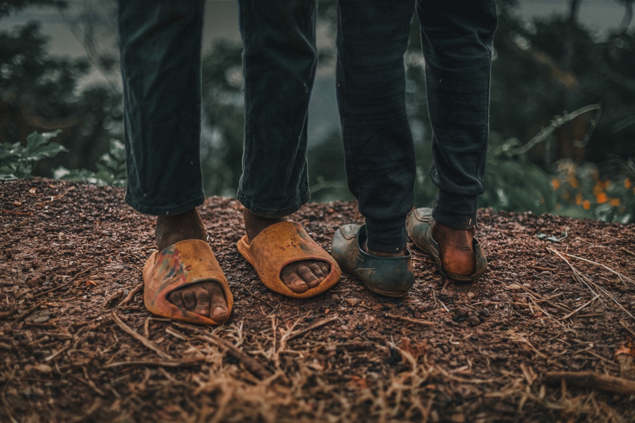 The Foot Condition Known as Morton’s Syndrome