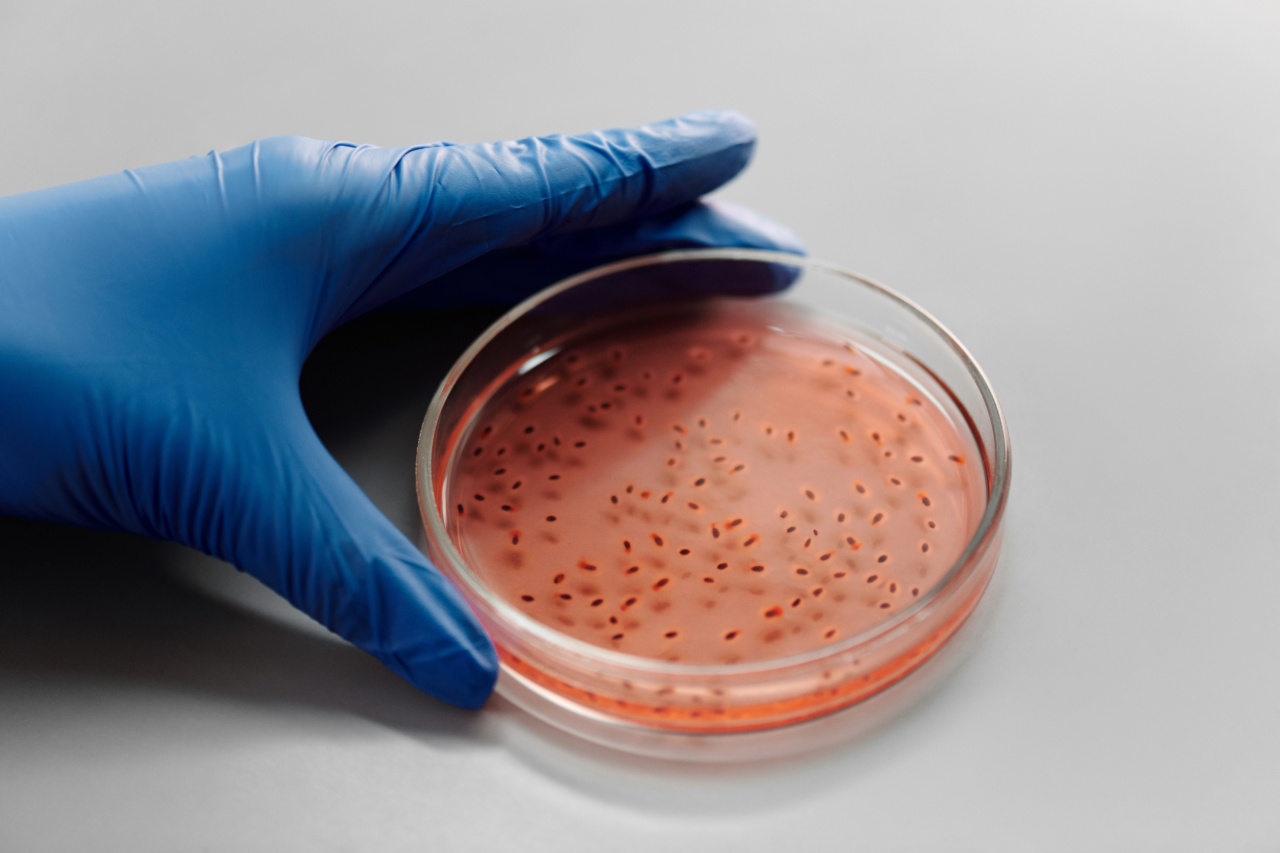 Examining the role of gut bacteria in Multiple Sclerosis