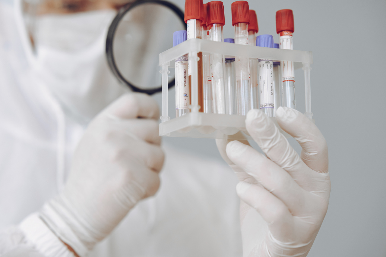 An innovative approach to diagnosing cancer with urine samples
