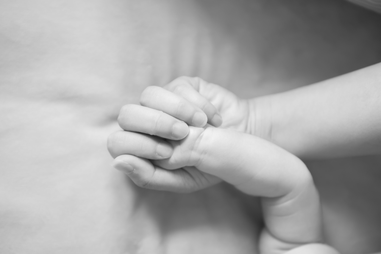 What Every Parent Should Know About Vitiligo in Their Baby