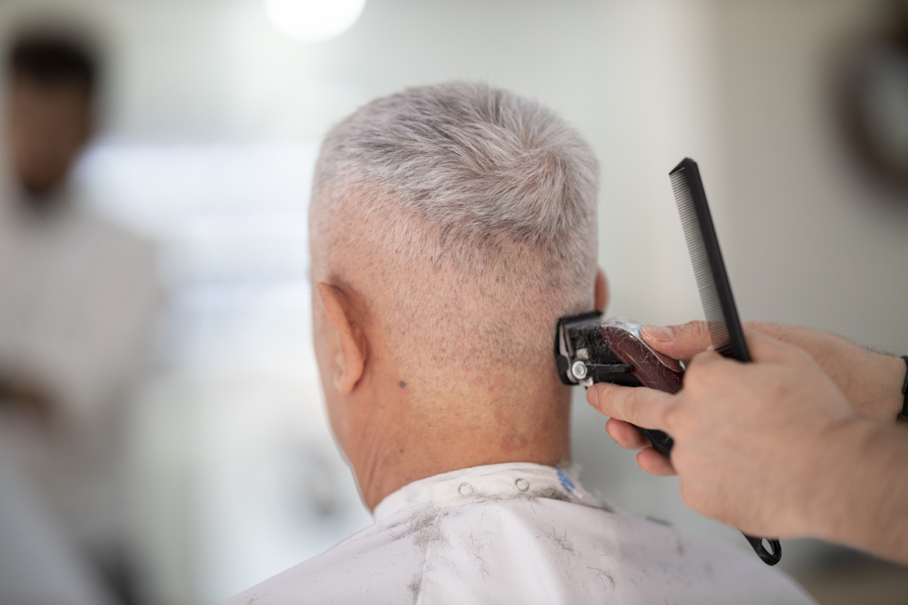 Laser Hair Removal: Grooming Trend among Men