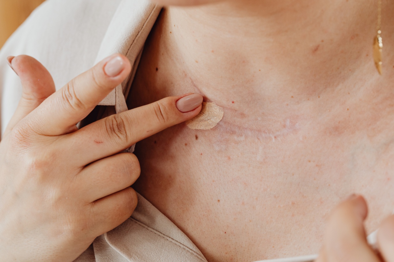 Exploring Scar Removal Coverage in Insurance