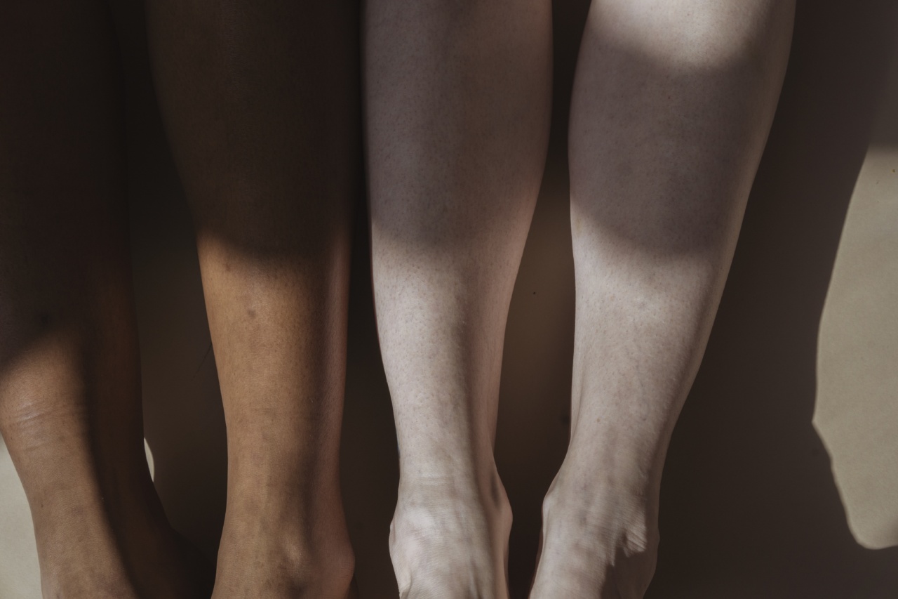 Thyroid disorders and the skin: A close relationship