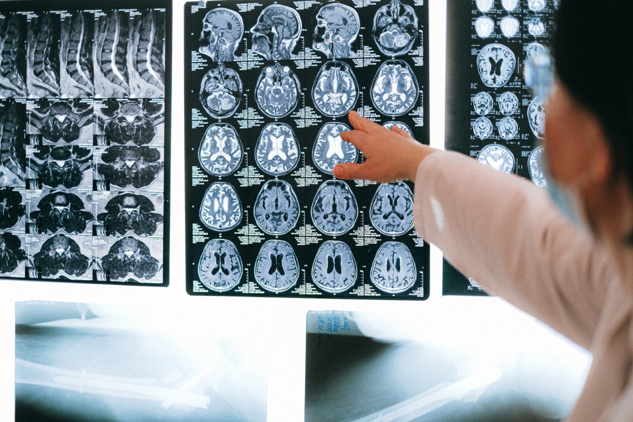 Shaky Hands: Examining Conditions Beyond Parkinson’s