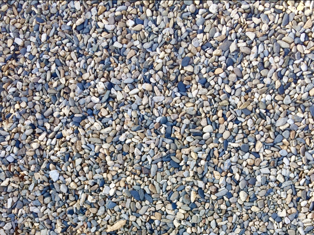 The Dos and Don’ts of Avoiding Kidney Stones