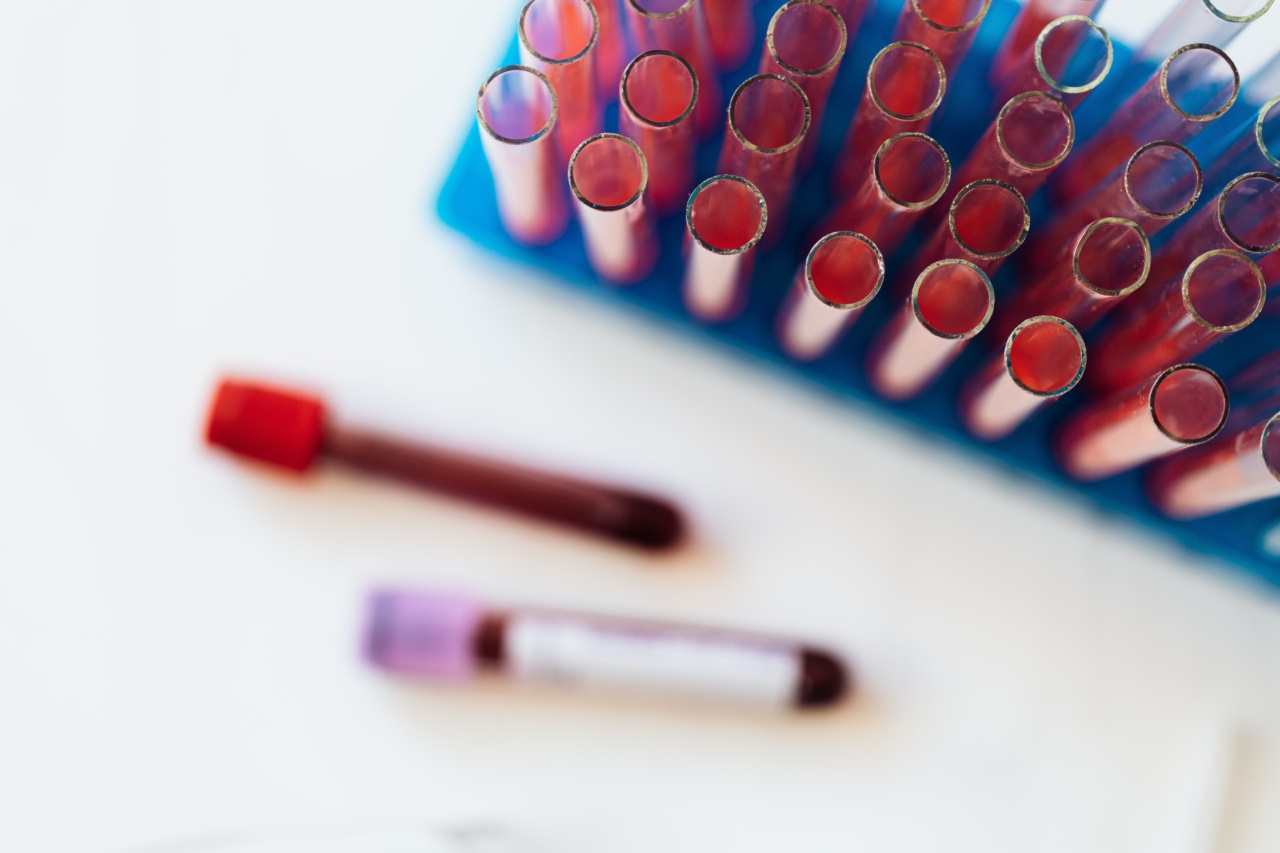 Blood Groups and Mortality: An Exploratory Study