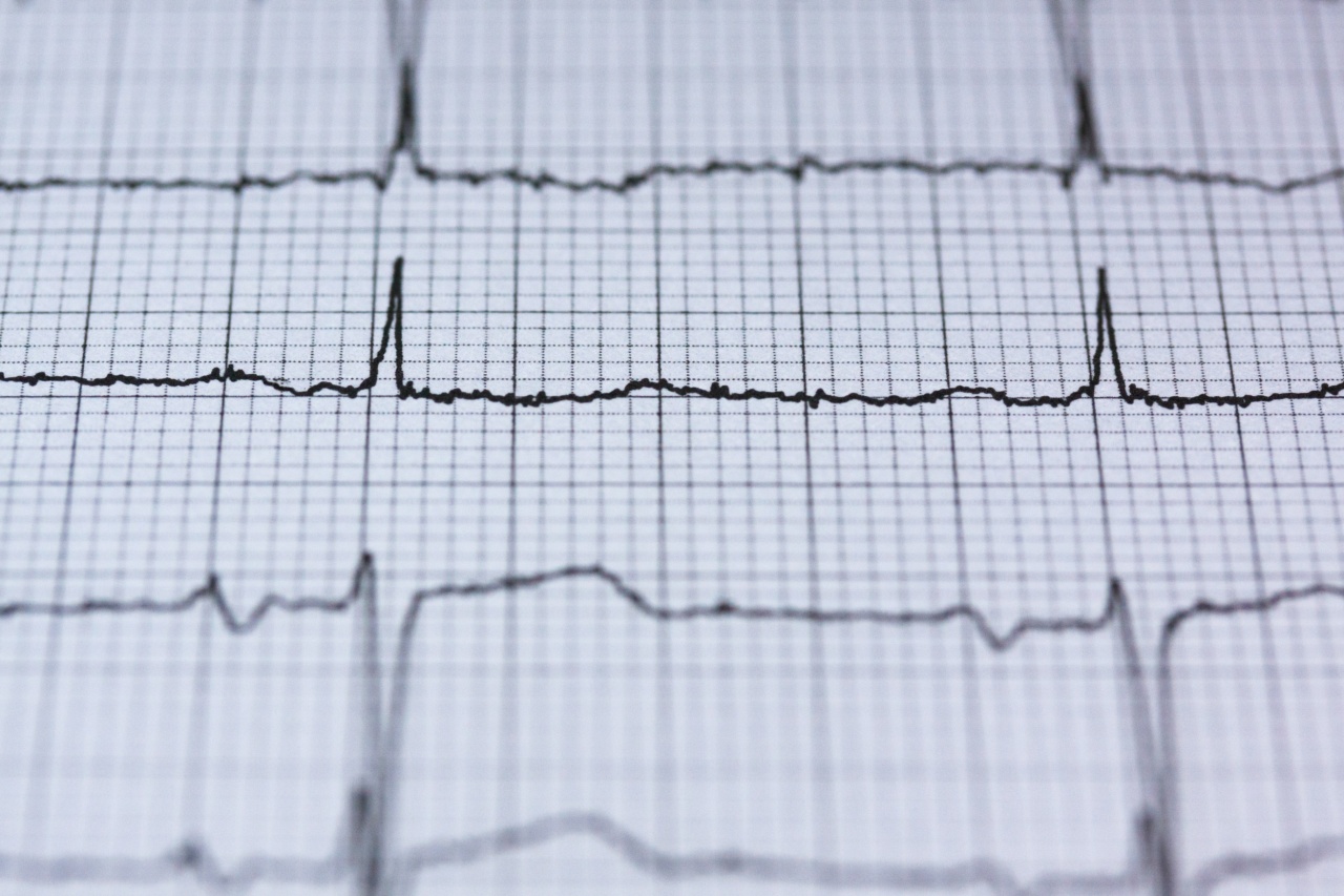 Keeping Your Heart Rhythm in Check: A Cardiac Exclusion Guide