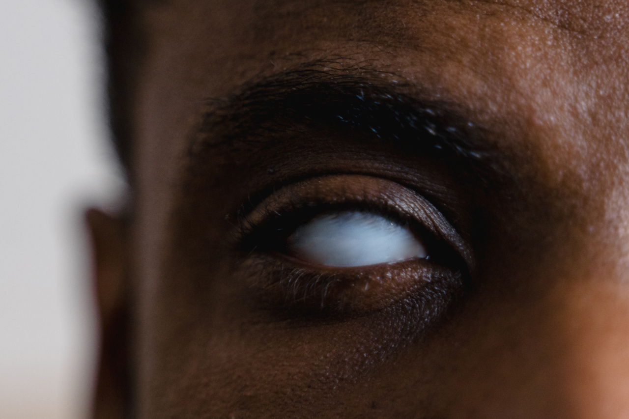 Don’t Turn a Blind Eye to Eyebrow Piercing Risks