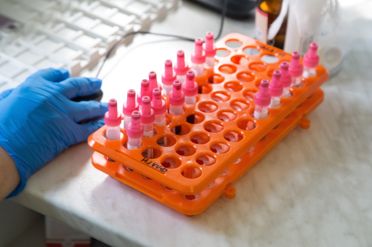 Revolutionary testing method for plasma samples and tumor tissue by Roche