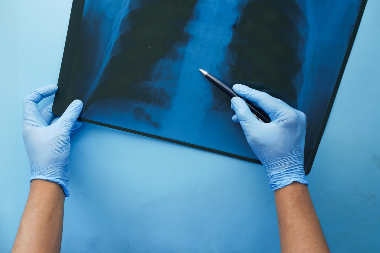 Foods for Faster Fracture Healing: A Picture Guide to Essential Nutrients