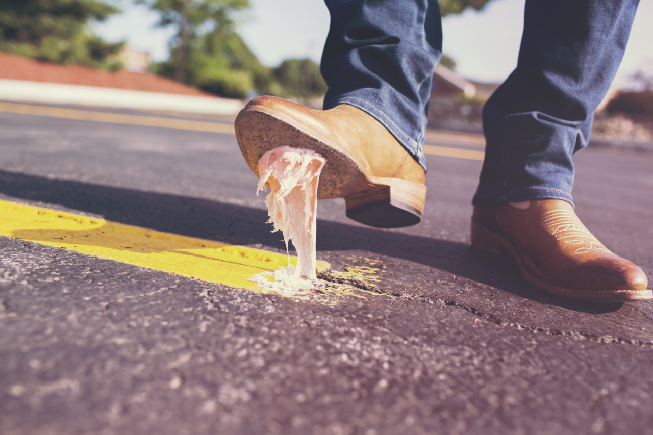 The first week of a diet: common pitfalls and reasons for failure