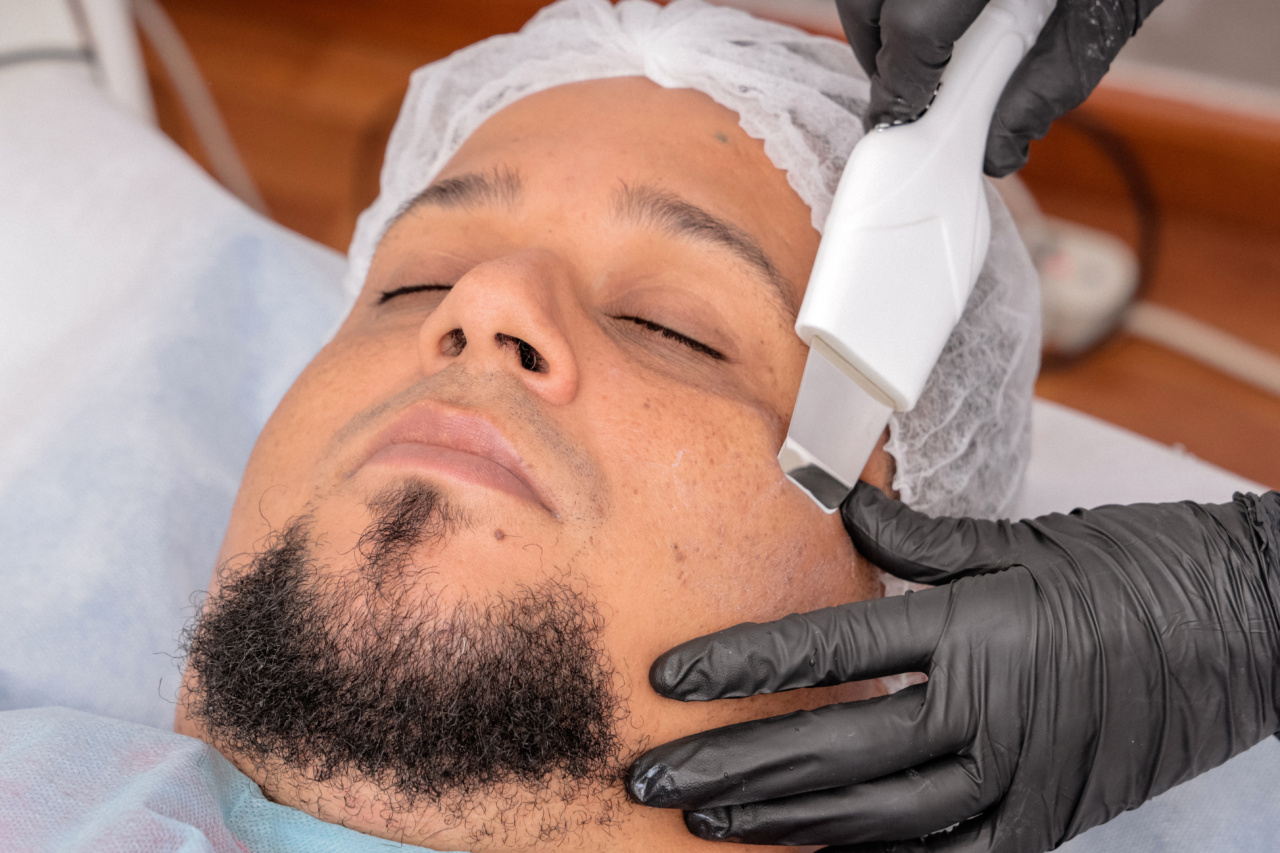 Renew your skin’s radiance with microcrystal face peeling