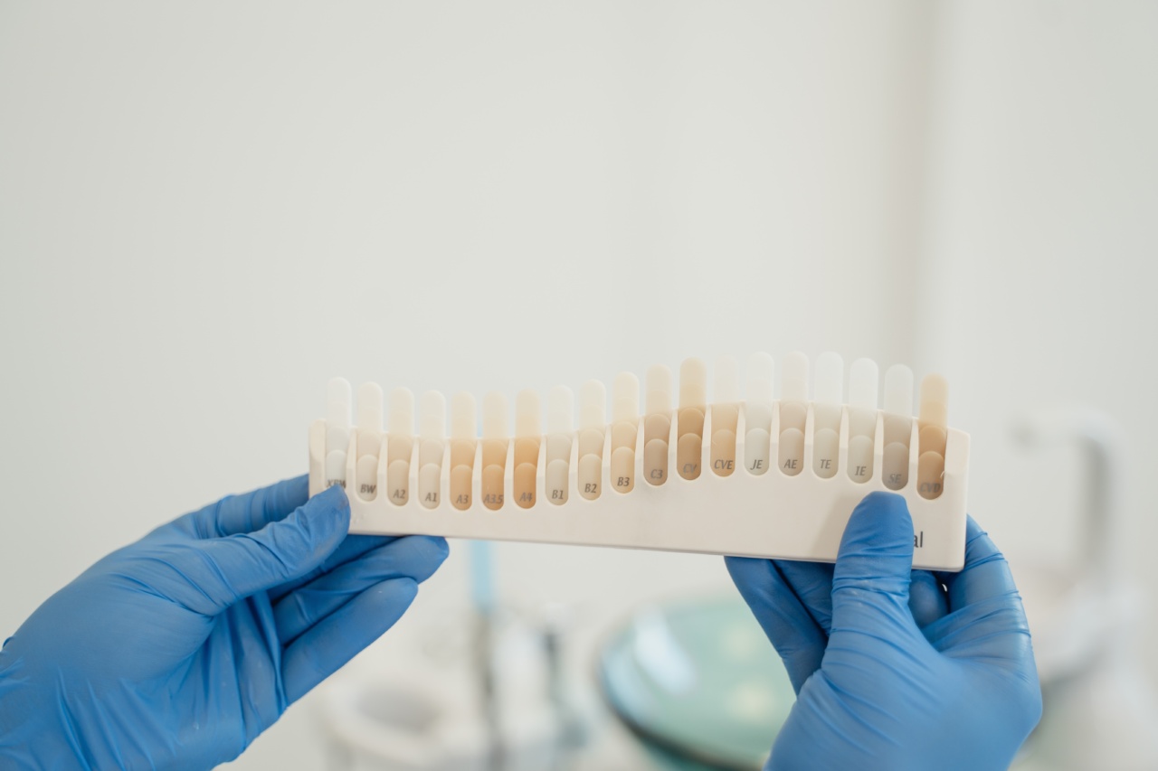 Haematuria: A Comprehensive Guide to Causes and Treatment