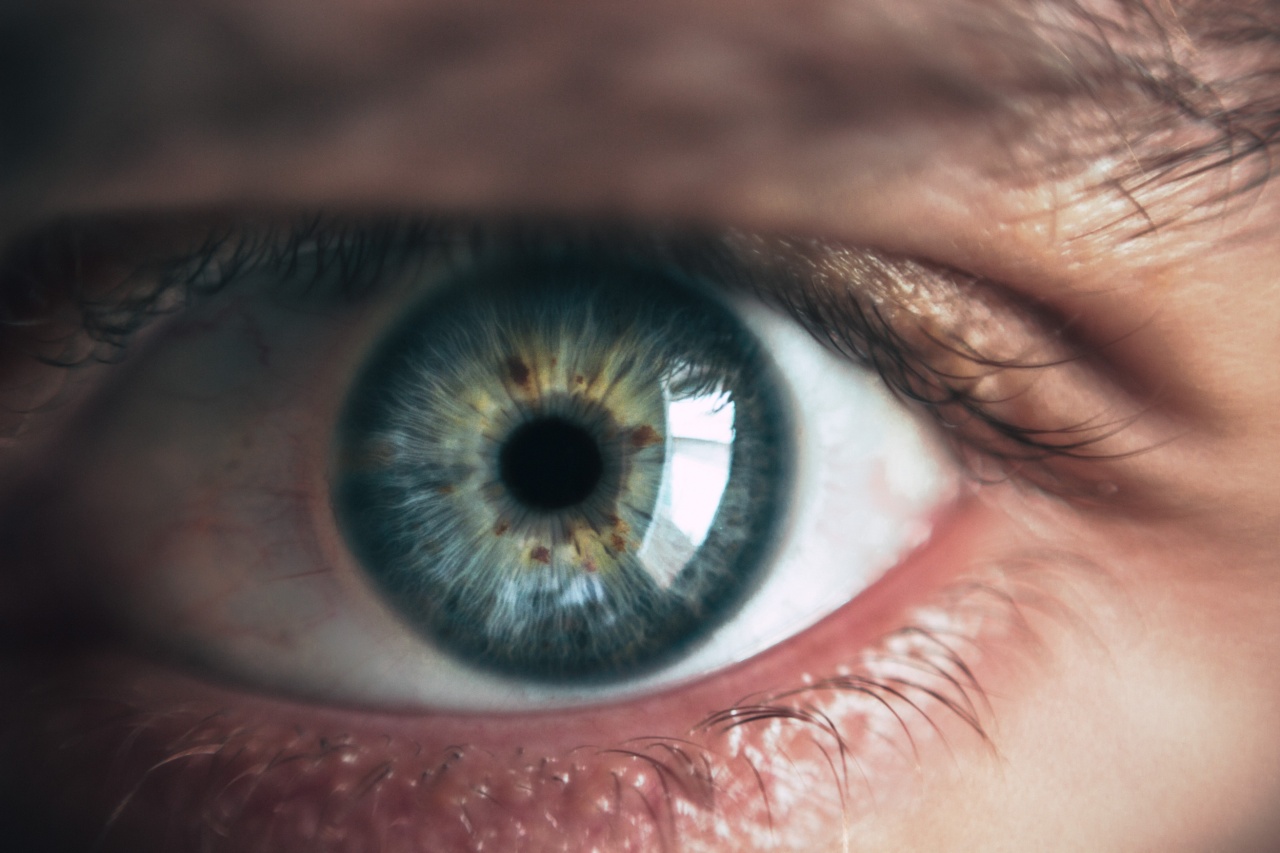 Preventing Cornea Injury: Understanding Dry Eye