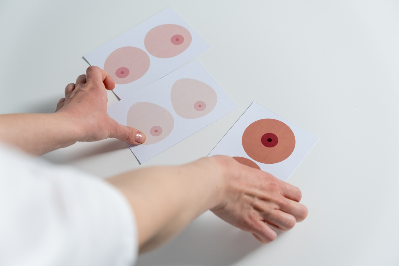 The Anatomy of a Benign Breast Tumor: Causes and Treatment