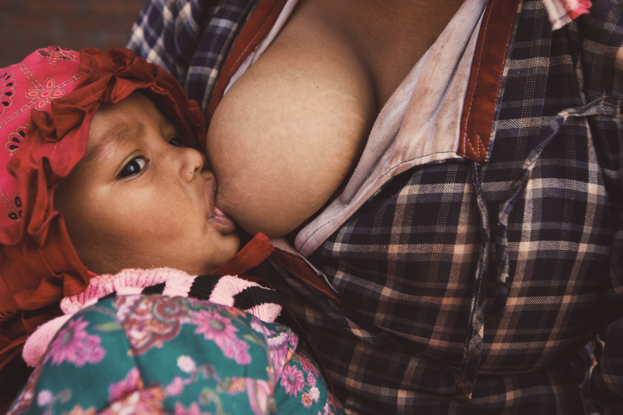 Ways to ease breast engorgement when breastfeeding