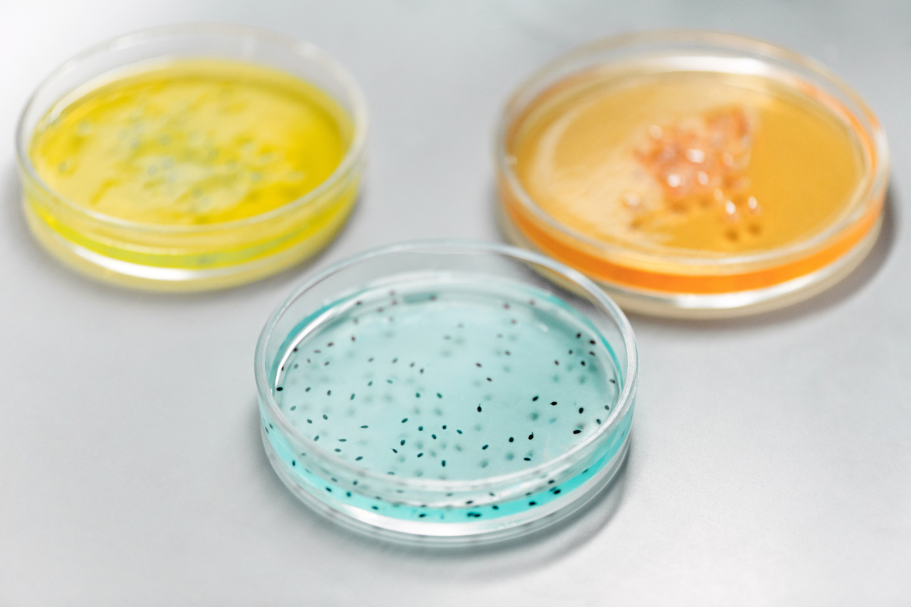 What health conditions can affect the color of your urine?