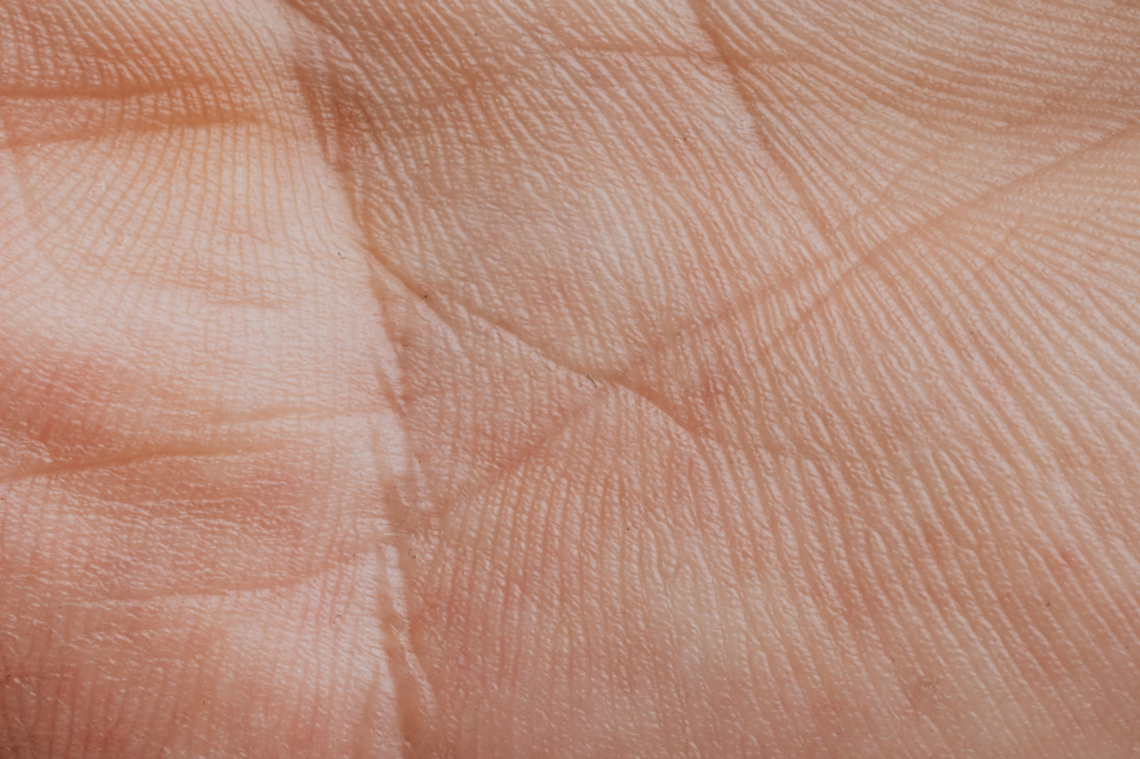 What do the lines on your hand indicate? Discovering diseases through palmistry
