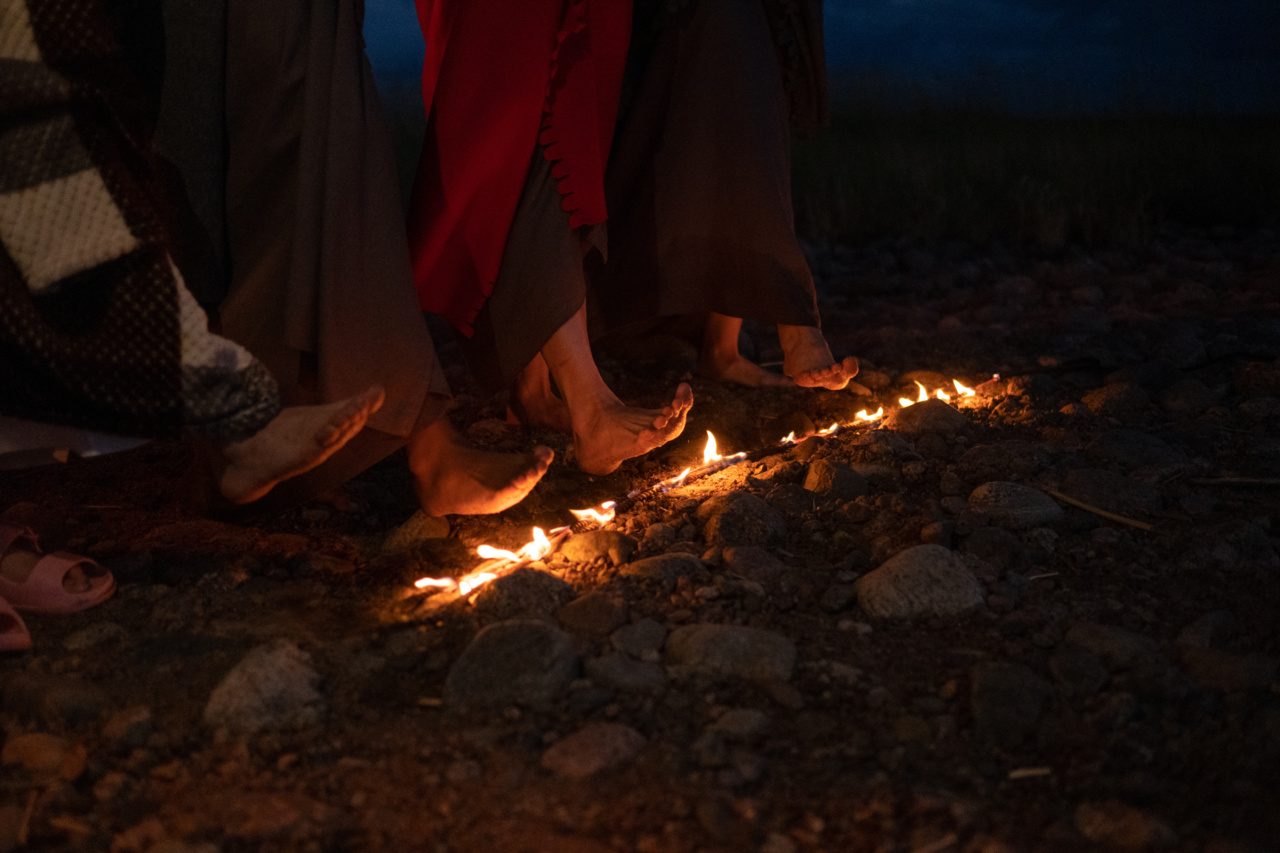 Possible Causes of Burning Feet