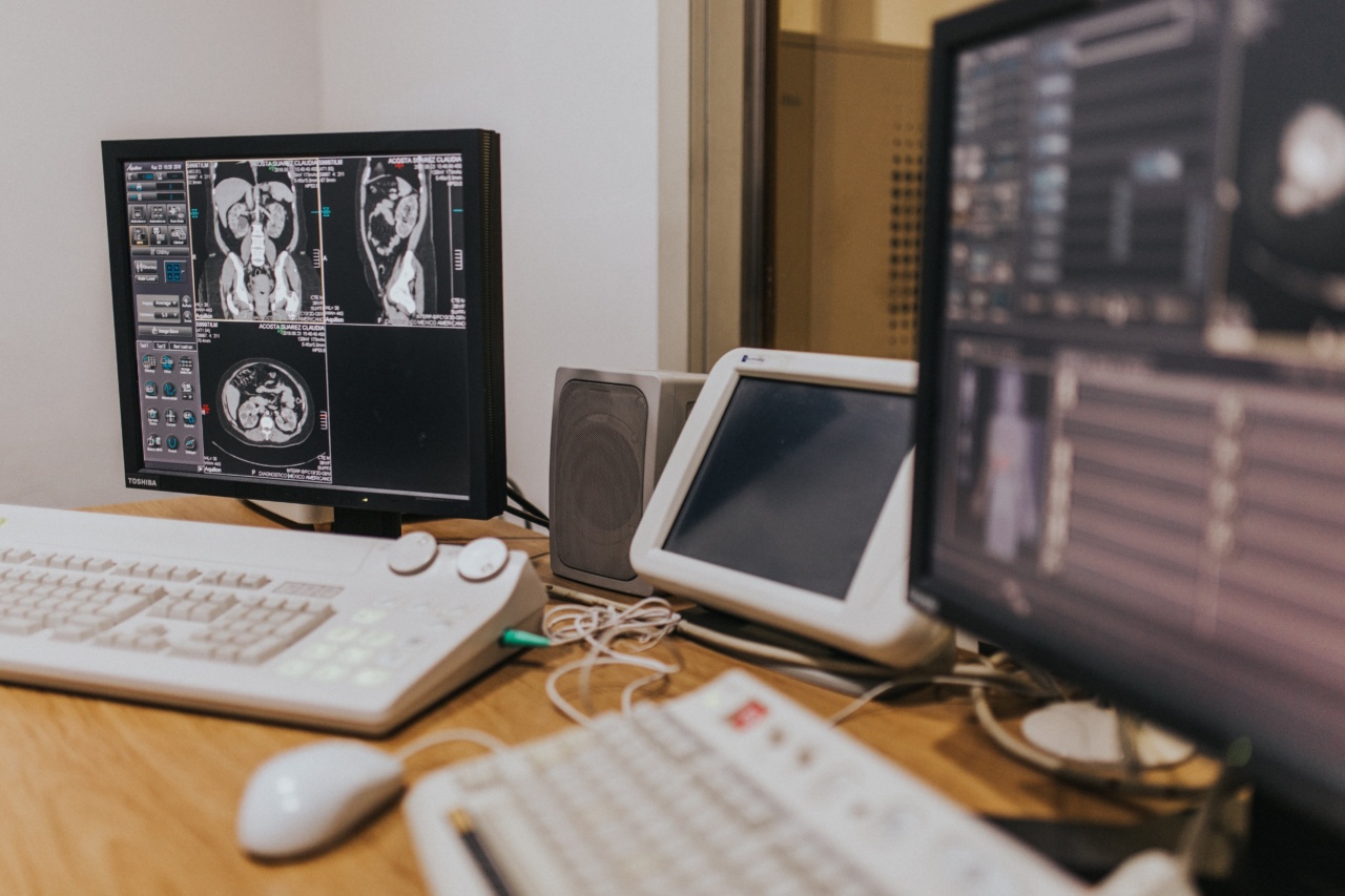 What MRI scans tell us about sex