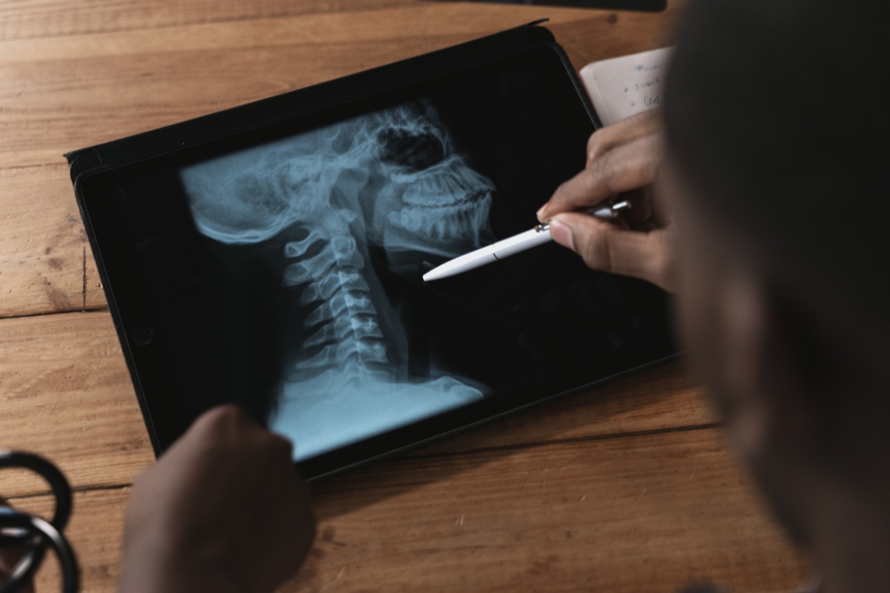 Understanding the Connection Between ADHD and Writing Struggles: Effective Treatment Techniques