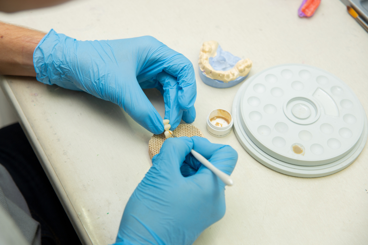 Medications that Cause Elimination of Dental Implants from the Body