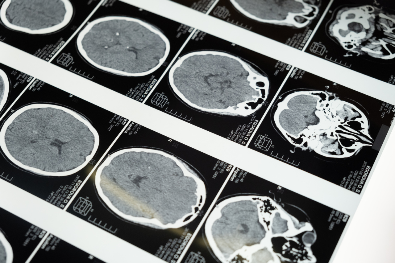 How does magnetic resonance imaging work?