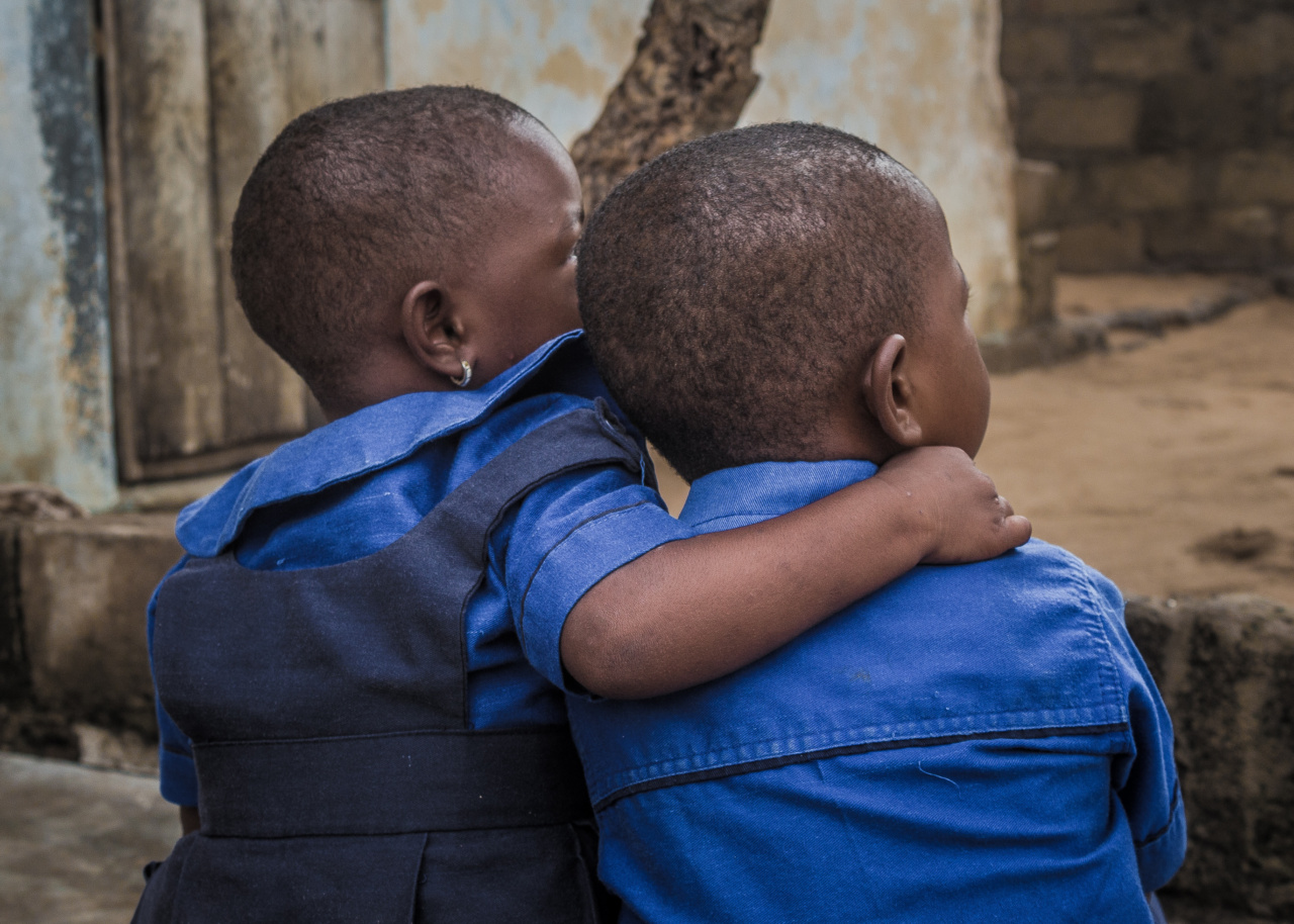Identical twin brother or sister? What changes about the health of the girl?