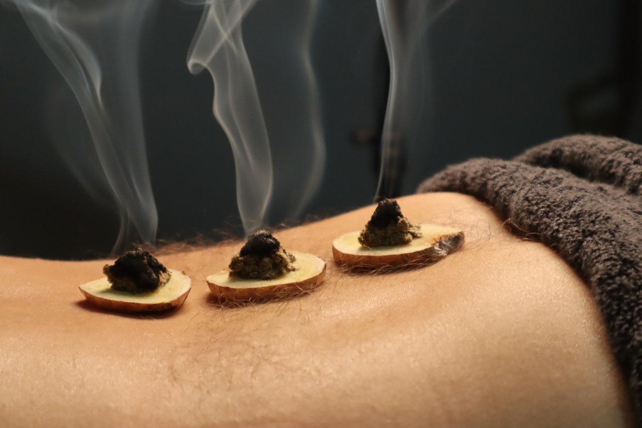 Why butter isn’t the best remedy for burns