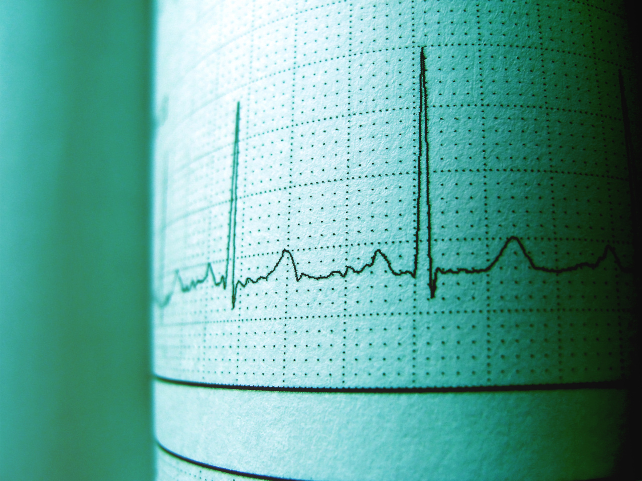 Heartbeat analysis to determine your likelihood of diabetes