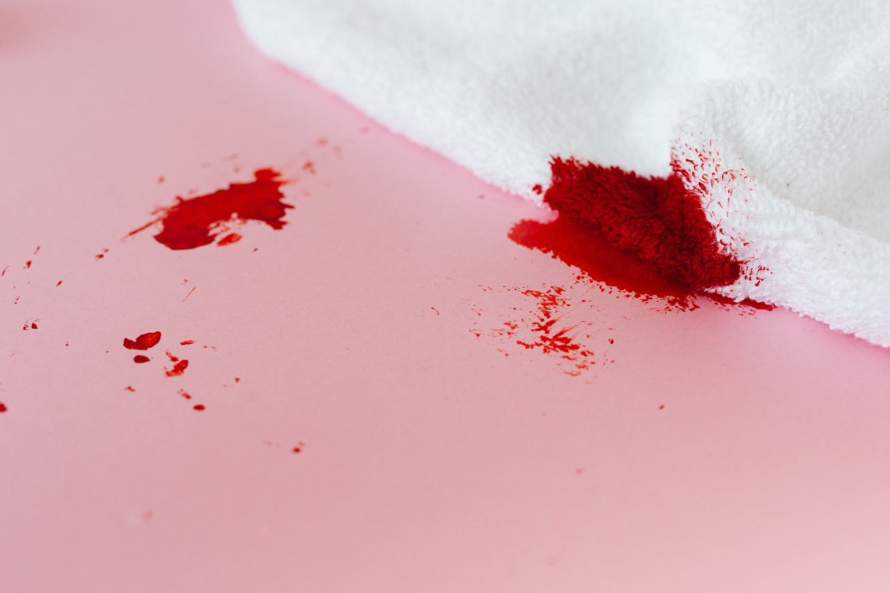 Inks and Blood Clots: A Comparison