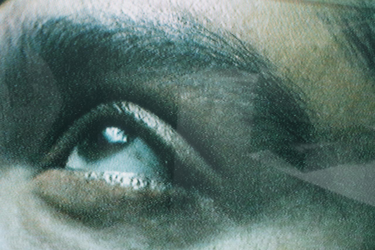 Why diabetic eye screenings are crucial