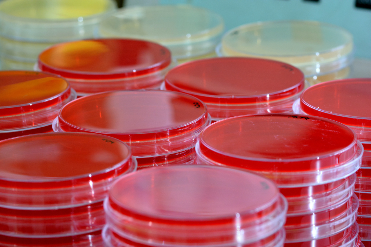 Innovative blood test for early pancreatic cancer screening