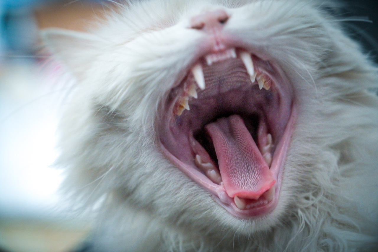 Persistent yawning and its management
