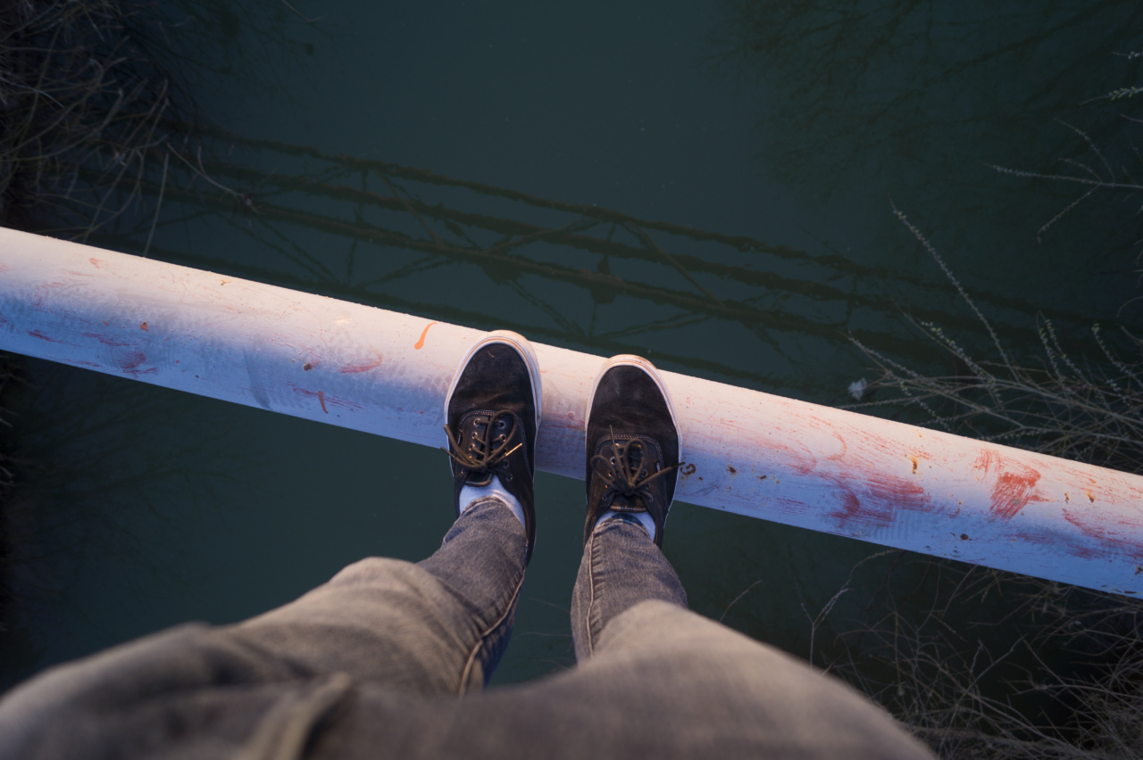 Foot discoloration and high cholesterol: Are you at risk?