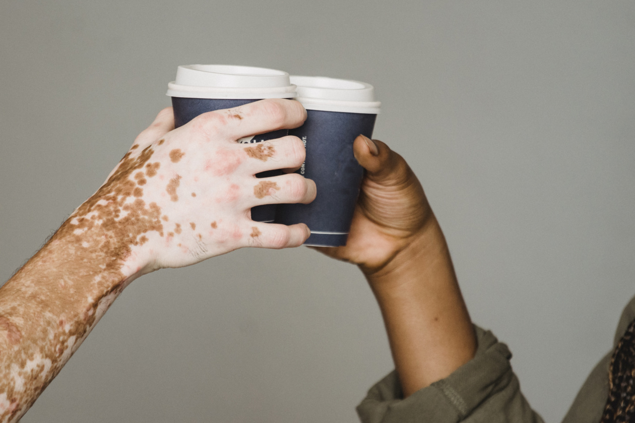 Is caffeine a potential Parkinson’s disease treatment?