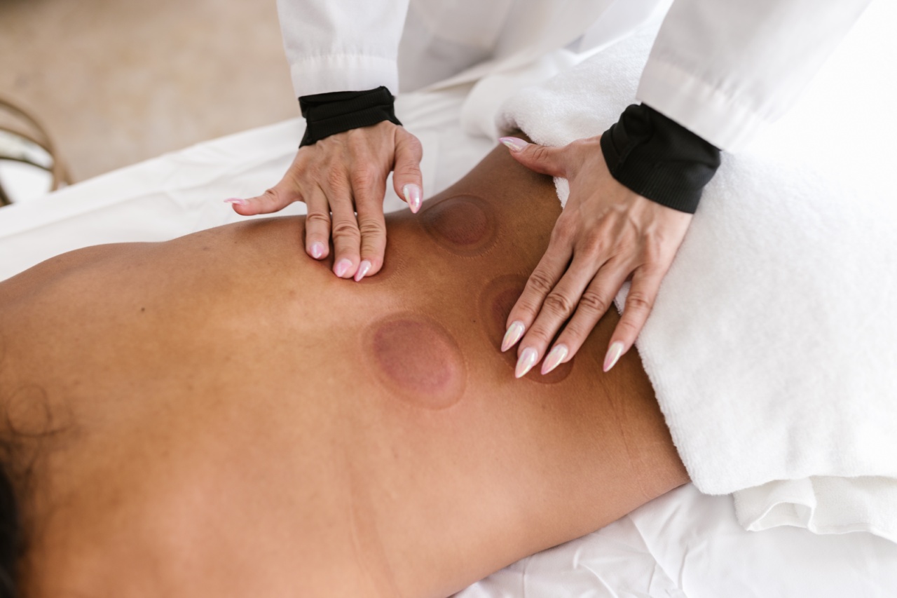 Eczema: Alternative Therapies for Soothing Skin (With Pictures)