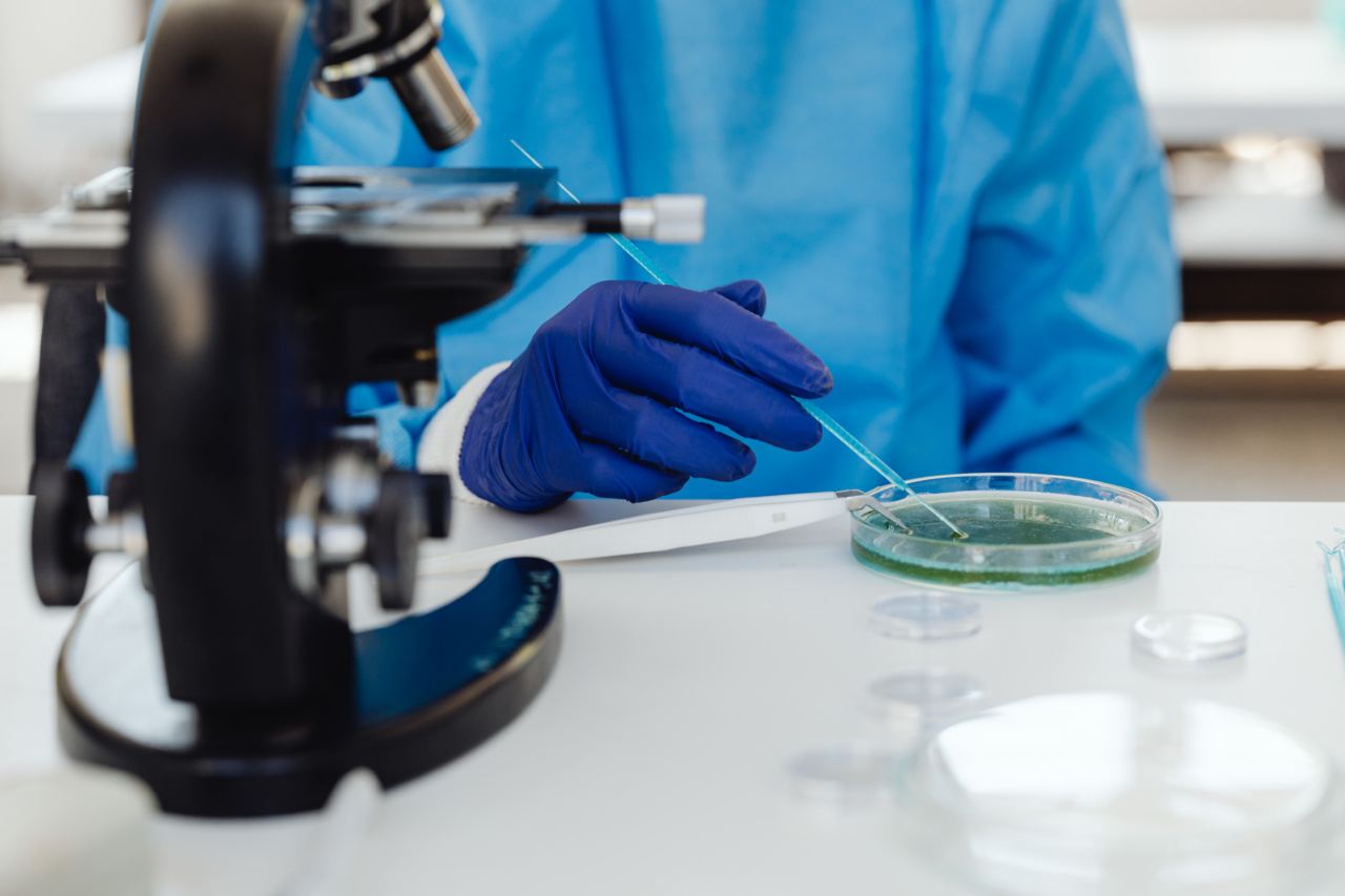 Examining the ceilings of surgical intervention fees