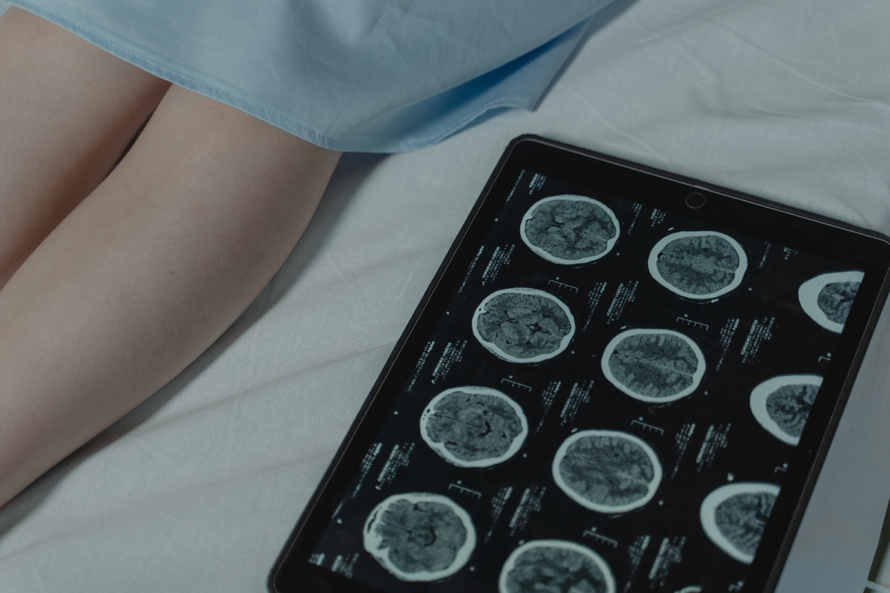 Smartphone-based cancer screening