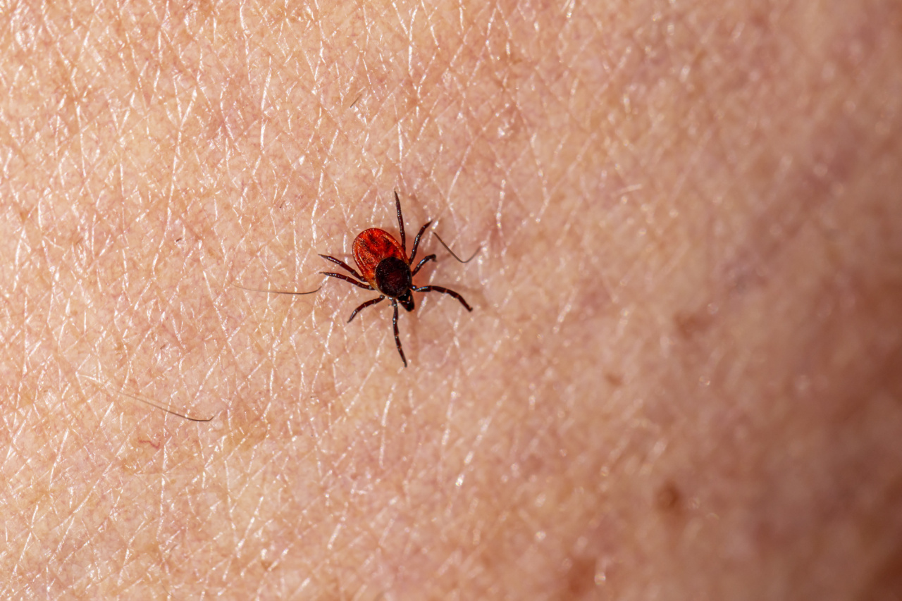 What to Do if You Find a Tick on Your Skin