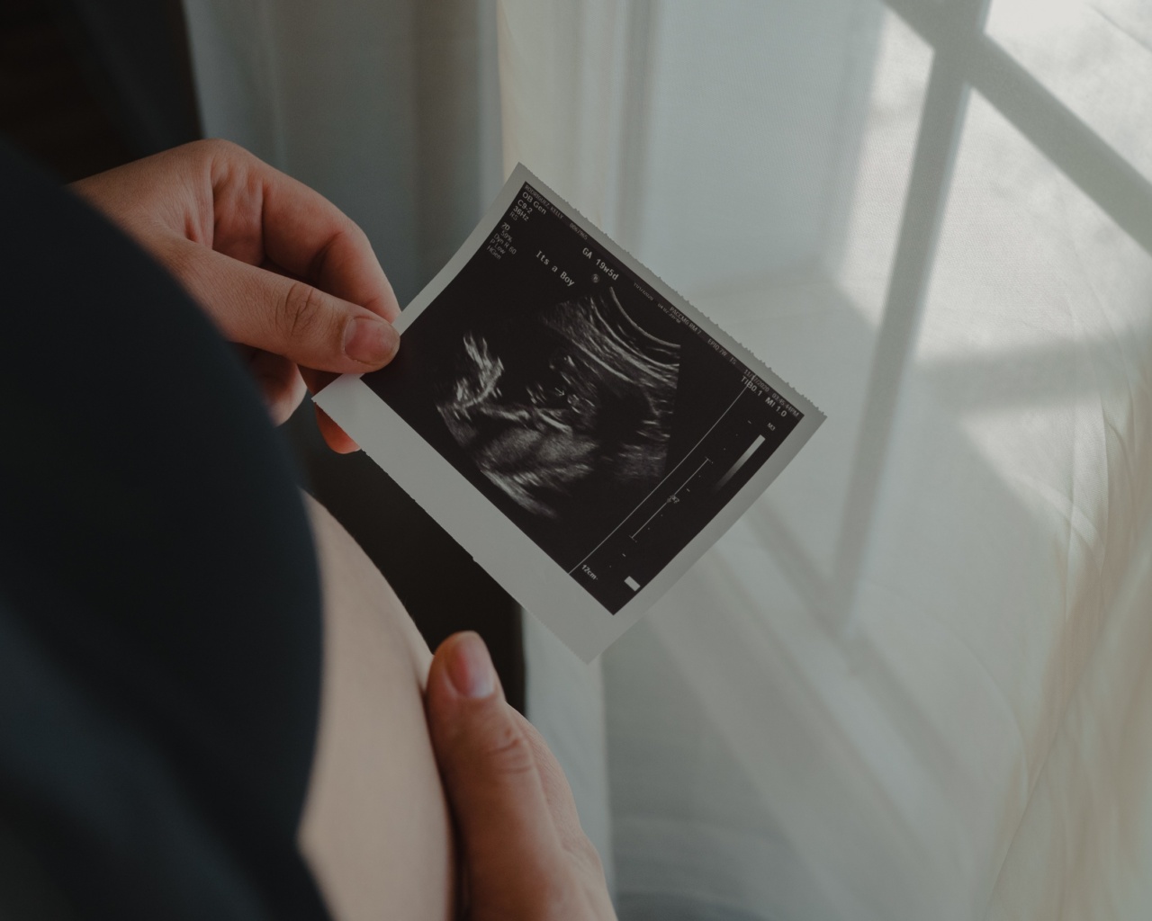 Meletii Study: Antipsychotic Use in Pregnancy Safe for Fetus