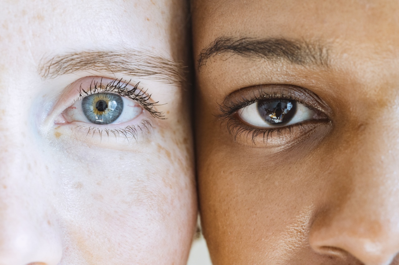 Brown Eyes: Over 10 different diseases occur with symptom