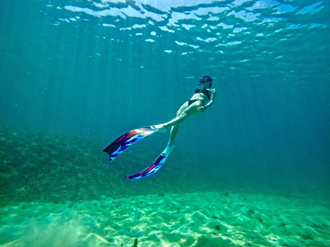 Diving into the Causes of Lethargy in Alzheimer’s Patients