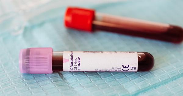 Accurate blood test can predict lymphoma progression