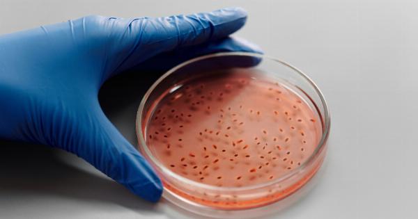 Examining the role of gut bacteria in Multiple Sclerosis