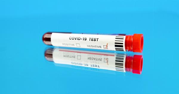 Significance of a delayed and negative test result