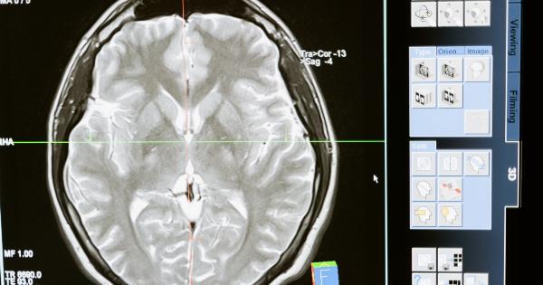Can one foot balance test predict brain health?