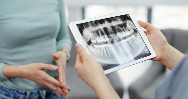 Is dental X-ray safe during pregnancy?