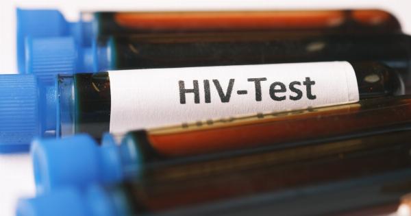 The Importance of HIV Testing